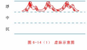 虚脉